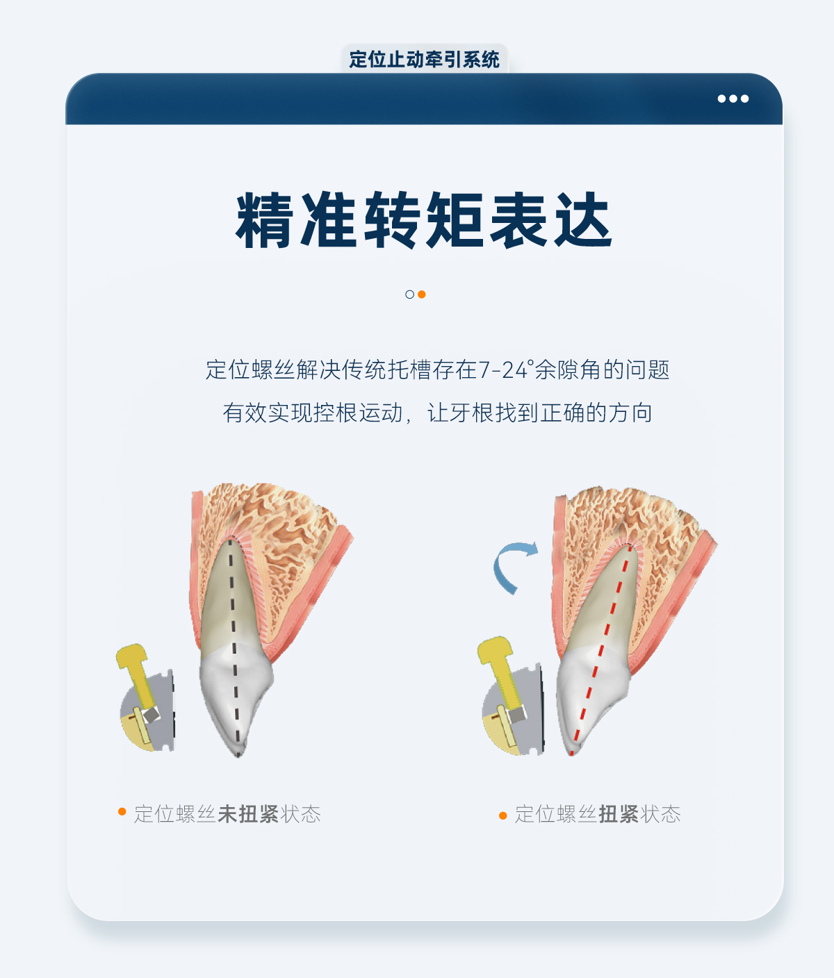 定位止动牵引系统_03.jpg