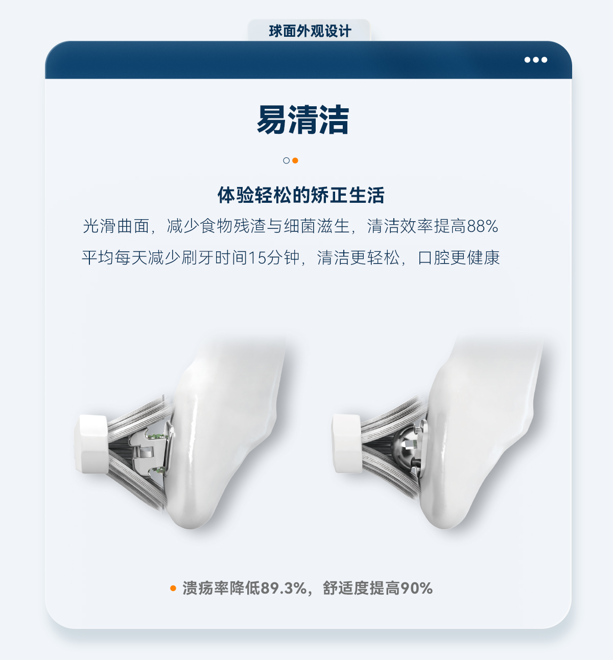 球面外观设计_04.jpg